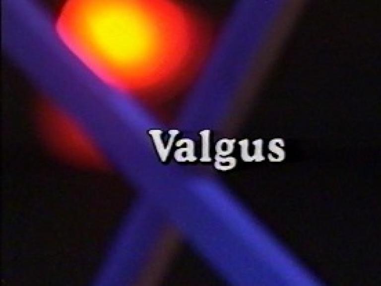 Valgus